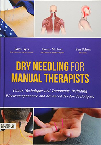 Product Cover Dry Needling for Manual Therapists: Points, Techniques and Treatments, Including Electroacupuncture and Advanced Tendon Techniques
