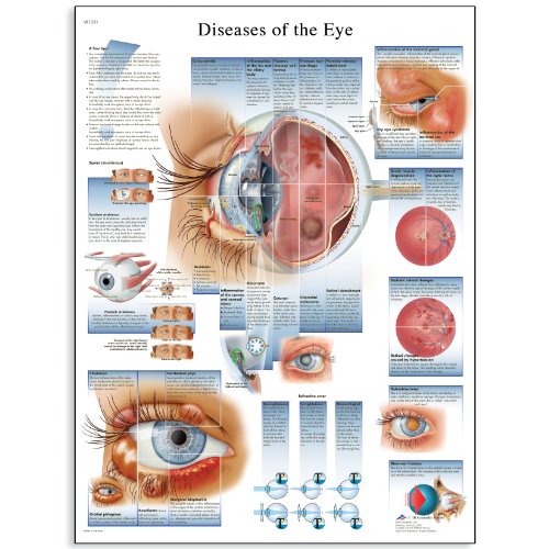 Product Cover 3B Scientific VR1231L Glossy Laminated Paper Diseases of The Eye Anatomical Chart, Poster Size 20