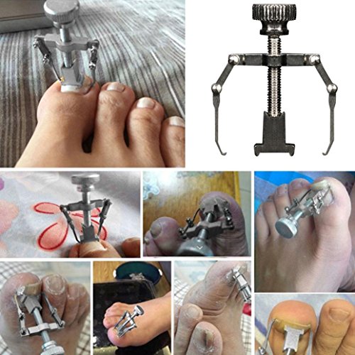 Product Cover DZT1968 1pc Waterproof stainless steel Ingrown Toe Nail Recover Correction Tool Pedicure Toenail Fixer Foot Nail Care