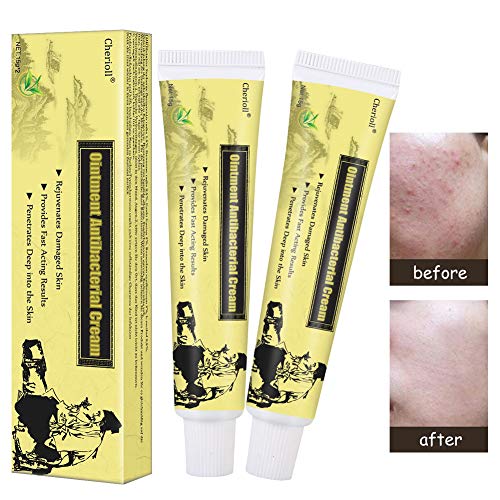 Product Cover Psoriasis Treatment,Psoriasis Cream for Dermatitis, Eczema,Natural Chinese Herbal Cream Eczema Dermatitis Psoriasis Vitiligo Skin Disease Treatment, 2pc