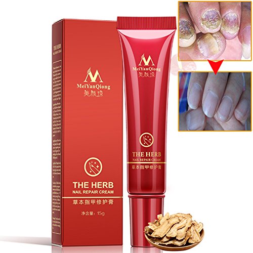Product Cover Yiwa Foot Nail Cream Protector Skin Care Cream Nail Fungus Treatment Herb Anti Fungal Nail Repair Cream