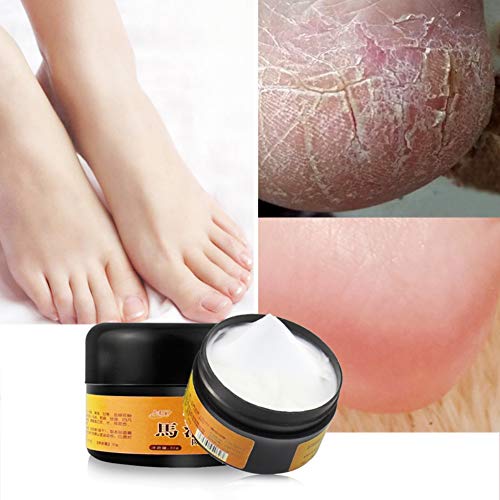 Product Cover Taykoo Horse Oil Premium Cracked Heel Balm Cream For Rough Dry & Cracked Chapped Feet Heel Skin,Moisturizing Cream For Adults And Kids