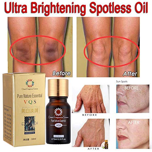 Product Cover Ultra Brightening Spotless Oil,Wishwin Skin Care Natural Pure Remove Ance Pure Nature Essential Oil Dark Spots Removal Age Spots Hyper-Pigmentation Brightening Skin Essence