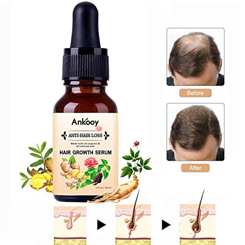 Product Cover Hair Growth Serum,2019 Hair Growth Oil,Hair Growth,Stops Hair Loss, Hair Thinning Treatment, Hair Growth Treatment,Hair Serum, Thinning,Balding,And Promotes Hair Regrowth For Women and Men