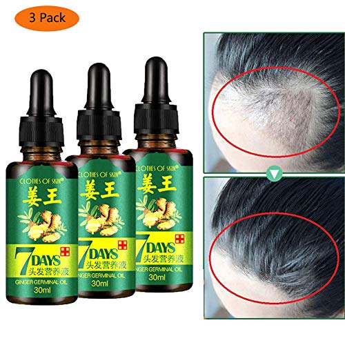Product Cover Hair Growth Oil Essence 2019 Hair Loss Liquid Dense Thicken Hair Supports Healthy Hair Growth for Women & Men