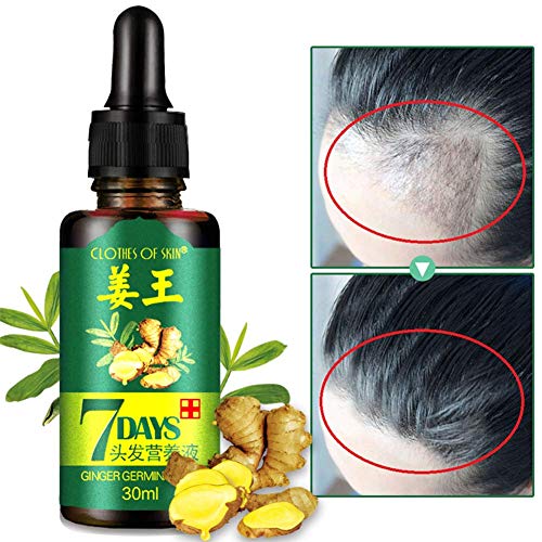 Product Cover Ginger Germinal Oil,2020 Hair Growth Ginger Essential Oil Hair Growth Hair Loss Treatment Hair Growth Serum for Men and Women