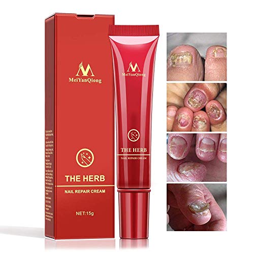 Product Cover Nail Repair Cream,Herb Nail Repair Cream Protector, Nail Care Treatment of Anti-Fungal Cream, Effective Against Nail Fungus, Restores the Healthy Appearance of Nails