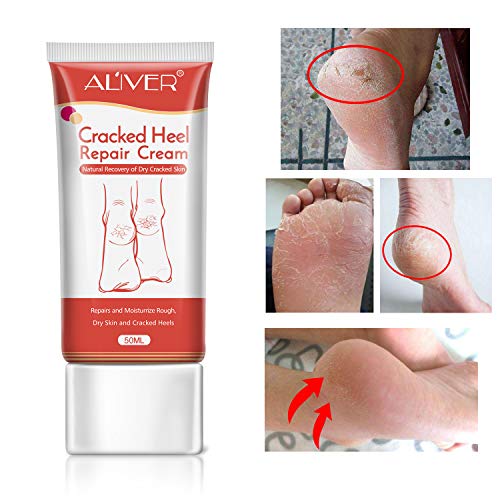 Product Cover Cracked Heel Cream, Foot Moisturizer, Foot Callus Remover Foot Skin Whitening Repair Cream, Softens And Intensively Hydrates For Thick, Cracked, Rough, Dead and Dry Feet Skin