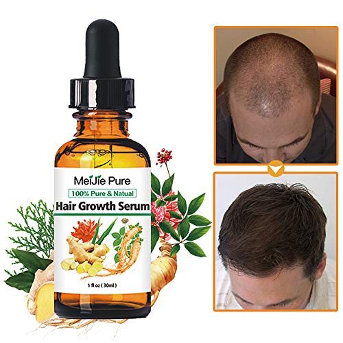 Product Cover Hair Growth Serum,2019 Hair Growth Treatment,Hair Serum,Anti Hair Loss, Thinning, Balding, Repairs Hair Follicles, Promotes Thicker, Stronger Hair , And Promotes Hair Regrowth