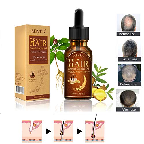 Product Cover Hair Growth Serum, Hair Growth Oil Essence, Hair Growth,Stops Hair Loss, Hair Thinning Treatment, Hair Growth Treatment,Hair Serum, Thinning, Balding, And Promotes Hair Regrowth For Women and Men