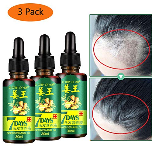 Product Cover Hair Growth Oil Serum Liquid Hair Loss for Women & Men Dense Thicken Hair