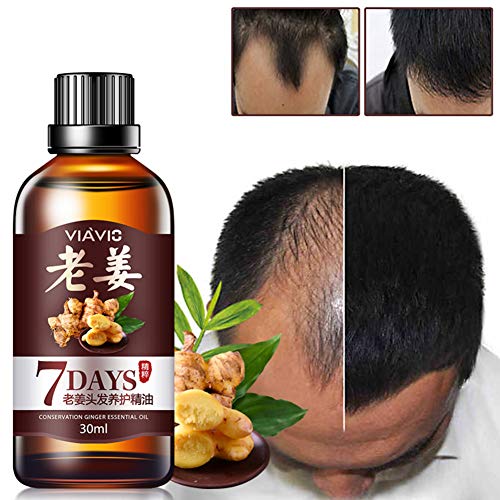 Product Cover DAGEDA New Ginger Hair Growth Oil Essence, Stops Hair Loss, Dense Thicken Hair, Treatment Balding Supports Healthy Hair Growth for Women & Men （30ml）