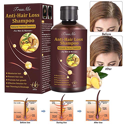Product Cover Hair Growth Shampoo, Hair Loss shampoo, Anti-Hair Loss Shampoo, Helps Stop Hair Loss, Grow Hair Fast, Hair Loss Treatment for Men & Women (220mL)